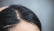 Prótesis Capilar para Raya y Coronilla: La Solución Perfecta para un Cabello Impecable
